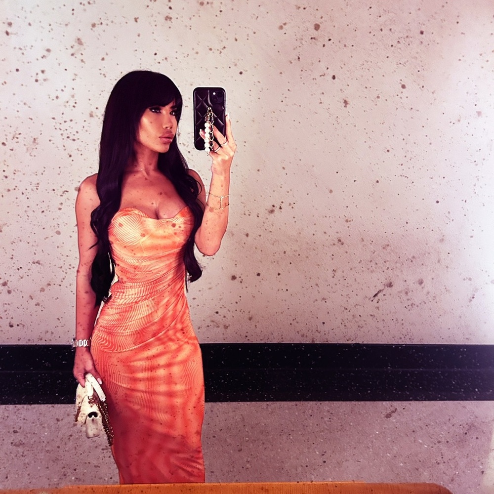 ZARA Dress